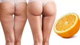 Top alimente care topesc celulita. Ce să mănânci ca să ai pielea fermă